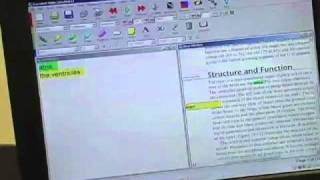 Assistive Software Demo ZoomText JAWS and Dragon [upl. by Ameluz]