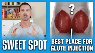 Best Place For Glute Injection  The Sweet Spot [upl. by Alethea266]