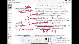 Ependymoma neurology 132  First Aid USMLE Step 1 in UrduHindi [upl. by Lebasiairam]