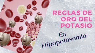 Hipokalemia hipopotasemia  Corrección intravenosa  Reglas de oro del Potasio [upl. by Nali]