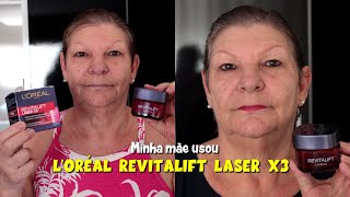 Minha mãe usou o Revitalift Laser X3 da Loreal [upl. by Eatnod998]