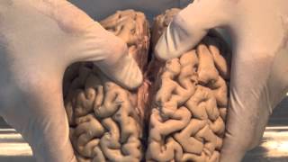 Introduction Neuroanatomy Video Lab  Brain Dissections [upl. by Swann289]