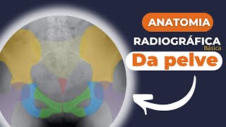 Radiologia Anatomia radiográfica básica da pelve e quadril [upl. by Oiruam]