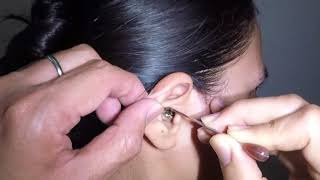 The Most EPIC Earwax Removal EVER [upl. by Hemingway583]