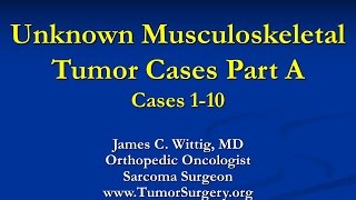 Orthopedic Oncology Course  Unknown Test Cases Part A Cases 110  Lecture 11 [upl. by Anrim382]