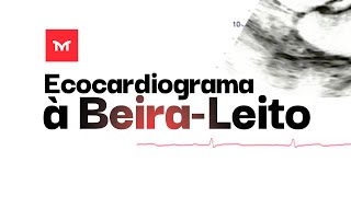 Ecocardiograma à BeiraLeito [upl. by Aneloj]