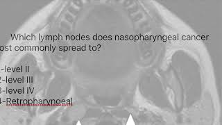 RETROPHARYNGEAL NODESNODES OF ROUVIERE [upl. by Nnarefinnej]