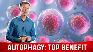 The Most Important Benefit of Autophagy Will Surprise You [upl. by Wilsey871]