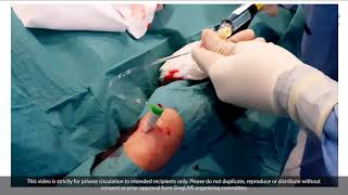 Transradial PCI and Rotablation  Singapore LIVE 2020 [upl. by Ainafets]