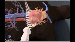 How To Apical 4Chamber View Echocardiography 3D Video [upl. by Pirzada]