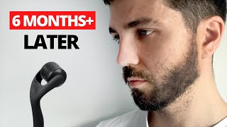 Beard Roller Before amp After  6 Month Update [upl. by Ajaj]