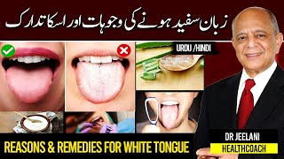 Reasons amp Remedies For White Tongue زبان سفید ہونے کی وجوہات اور اسکا تدارک UrduHindi By Drjeelani [upl. by Oninrutas928]