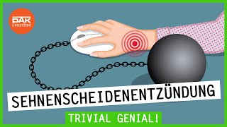 Sehnenscheidenentzündung – wenn die Gelenke schmerzen  Trivial Genial  DAKGesundheit [upl. by Aisha]