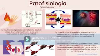 Síndrome de Disfunción Orgánica Múltiple [upl. by Gennifer]