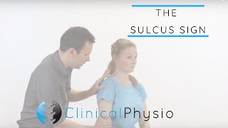 Sulcus Sign  Clinical Physio [upl. by Weiman]