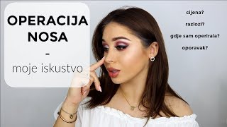 OPERIRALA SAM NOS I MOJE ISKUSTVO I ndgmakeup [upl. by Tammany]