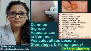 Signs in common Vesiculobullous Lesions Pemphigus amp Pemphigoids [upl. by Anileme]