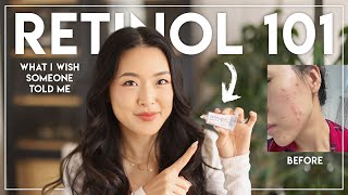 RETINOL 101  beginners guide amp everything I wish I was told [upl. by Matias]