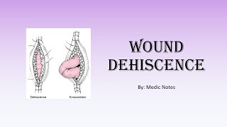 Wound dehiscence  risk factors clinical features investigation management prevention [upl. by Adianez]