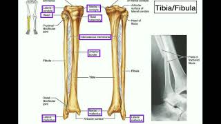 Anatomy  Specific Parts of the Tibia amp Fibula  Left vs Right [upl. by Deenya284]