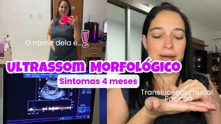 Fiz Ultrassom Morfológico do 1° Trimestre com 13 Semanas Sintomas 4 meses e Escolhemos o nome dela [upl. by Mayhs656]