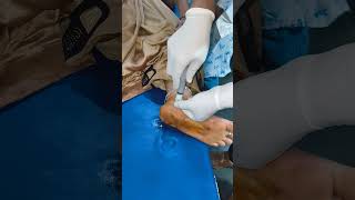 INTRAARTICULAR INJECTION FOR ANKLE PAIN [upl. by Craner]