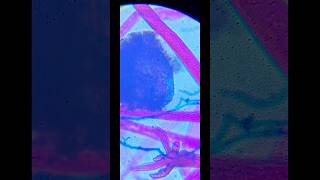 Rhizopus sp under microscope  Microbiology education shorts [upl. by Suiravad]