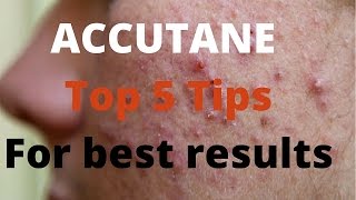 Accutane 5 tips by Dermatologists [upl. by Aieken]