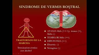 2024 Fisiopatologia de Sindromes Cerebelosos [upl. by Nitz]