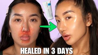 HOW I HEALED MY SKIN USING KBEAUTY 😍 REPAIR YOUR SKIN BARRIER [upl. by Hailed548]