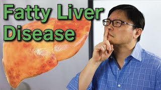 How to Reverse Fatty Liver Disease Naturally  Jason Fung [upl. by Suivat]