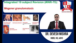 🕉 Integrated 19 subject Revision INR75 Wegener granulomatosis by Dr Devesh Mishra [upl. by O'Conner]