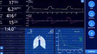 Obtaining Plateau Pressures [upl. by Toma]