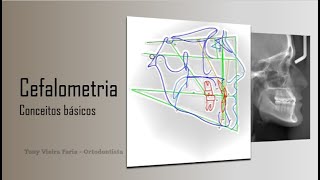 Cefalometria conceitos básicos [upl. by Ezeerb]