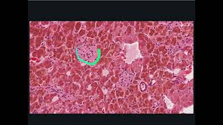 Endocrine System Histology  Adrenal Medulla [upl. by Ruscio]