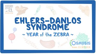 EhlersDanlos syndrome Year of the Zebra [upl. by Hertz]