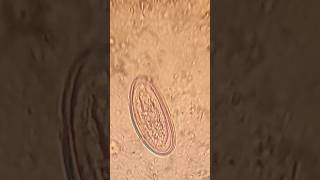 بويضة الدودة الدبوسية Enterobius Vermicularis Pinworm egg [upl. by Cochrane]