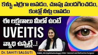 Types of uveitis  Uveitis symptoms telugu  Uveitis in telugu  Health video  DrSahiti Salguti [upl. by Geno]