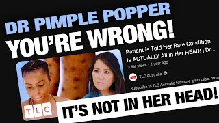 Calling Out Dr Pimple Popper  Mysterious Rash Prurigo Nodularis [upl. by Lairbag]