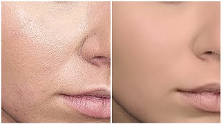 HOW TO AVOID CAKEY FOUNDATION TIPSampTRICKS FOR OILY AND DRY SKIN [upl. by Leboff]