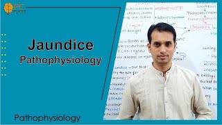 Jaundice Pathophysiology and Treatments [upl. by Repard37]