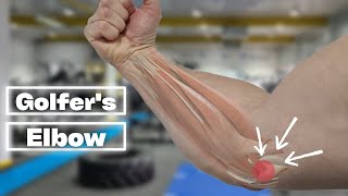 5 BEST Exercises For Golfers Elbow Rehab TRY THESE [upl. by Davine]