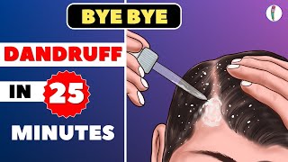 🔥1 Dandruff Treatment at Home  How to get rid of Dandruff  Dandruff Removal  Itchy scalp [upl. by Leandra]