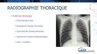 4 23 1 Exacerbation sévère dasthme  diagnostic et prise en charge [upl. by Arobed321]