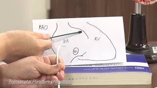 AF Ablation 3 Trans septal puncture [upl. by Lacee]