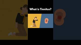 What is Tinnitus [upl. by Ninos]