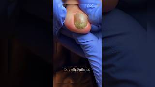 Nails satisfying pedicure shorts nails satisfying pedicure [upl. by Notterb]