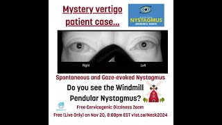 Have you seen this mystery nystagmus before [upl. by Ise83]