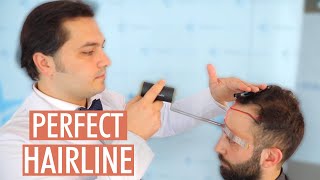 Hairline Transplant  How is the Perfect Hairline Created  Dr Balwi Explains [upl. by Gorga]