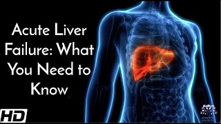 Acute Liver Failure What You Need To Know [upl. by Imogen237]